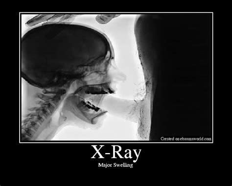 Hentai xray Search